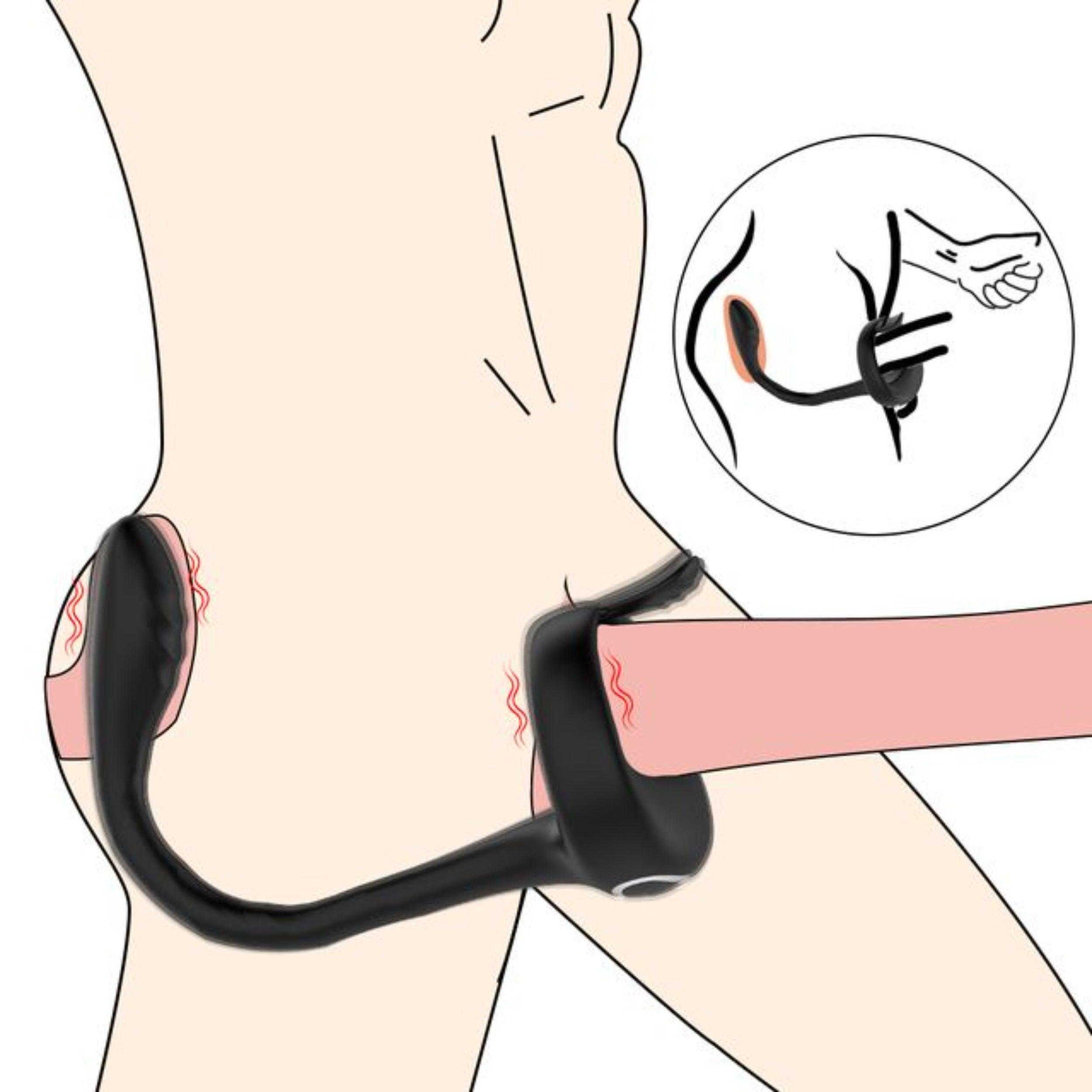 Vibrating Prostate Locking Cock Ring with Clit Tickler - Xoxomoving